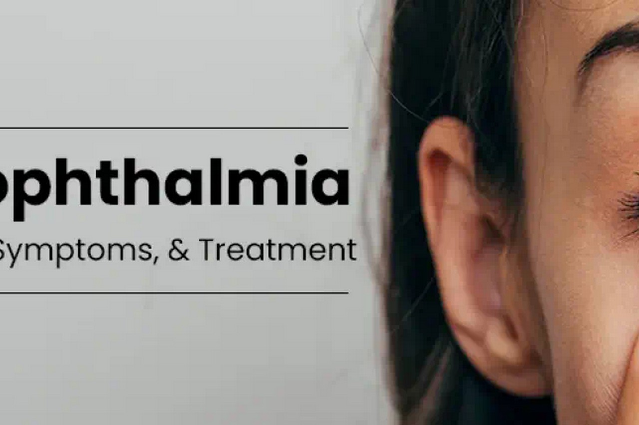 What is Xeropthalmia: Reasons, Signs And Symptoms, and Therapy Choices